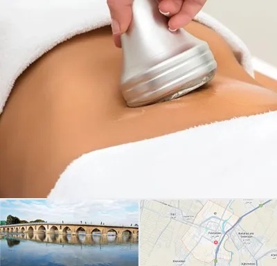 دستگاه لاغری در فلاورجان