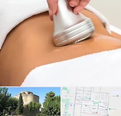 دستگاه لاغری در مرداویج اصفهان 