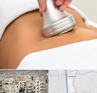 دستگاه لاغری در اسکندری