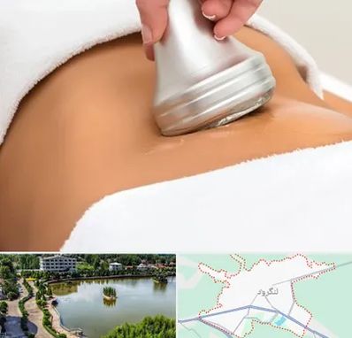دستگاه لاغری در لنگرود