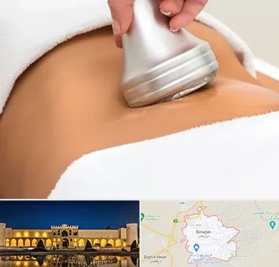 دستگاه لاغری در برازجان