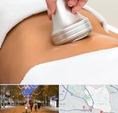 دستگاه لاغری در ولیعصر ارومیه