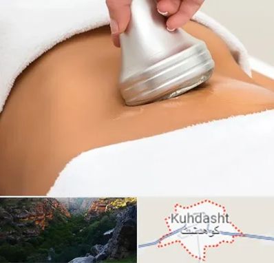 دستگاه لاغری در کوهدشت