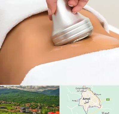 دستگاه لاغری در آمل