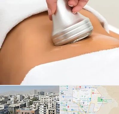 دستگاه لاغری در منطقه 14 تهران