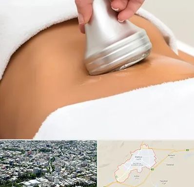 دستگاه لاغری در شاهرود