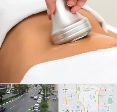 دستگاه لاغری در ستارخان 