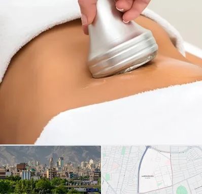 دستگاه لاغری در جمشیدیه