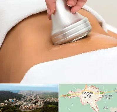 دستگاه لاغری در گرگان