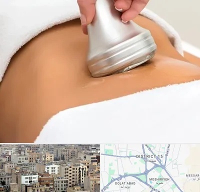 دستگاه لاغری در جنوب شرق تهران