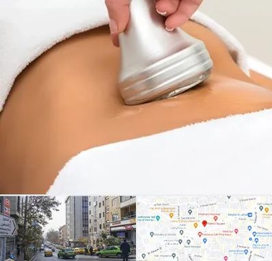 دستگاه لاغری در فاطمی 