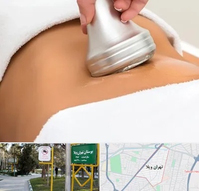 دستگاه لاغری در تهران ویلا