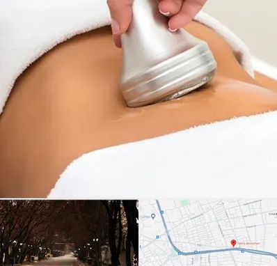 دستگاه لاغری در ابوریحان تبریز