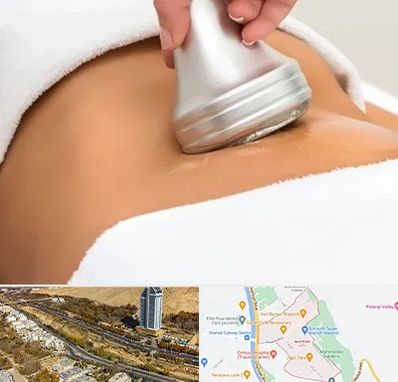 دستگاه لاغری در خیابان نیایش شیراز 