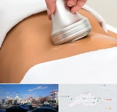 دستگاه لاغری در ماهدشت کرج 