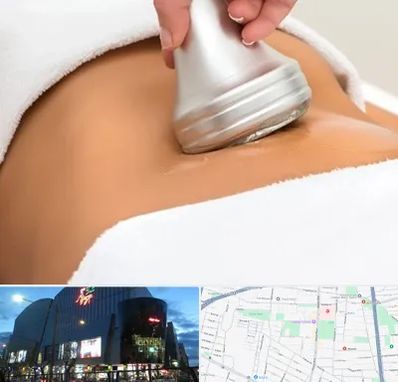 دستگاه لاغری در بلوار اباذر
