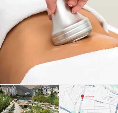 دستگاه لاغری در بلوار تعاون