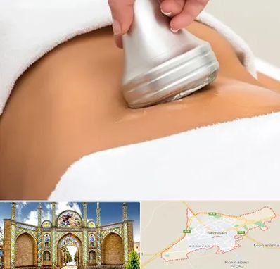 دستگاه لاغری در سمنان