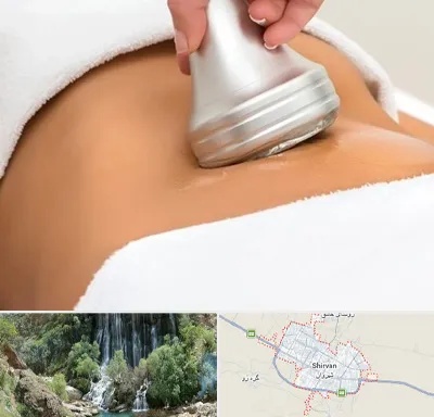 دستگاه لاغری در شیروان