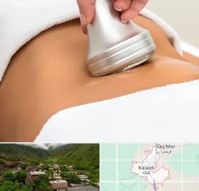 دستگاه لاغری در کلاله