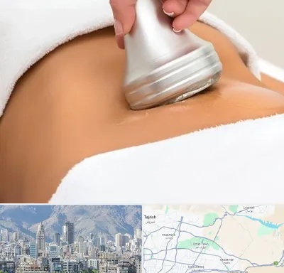 دستگاه لاغری در شمال شرق تهران