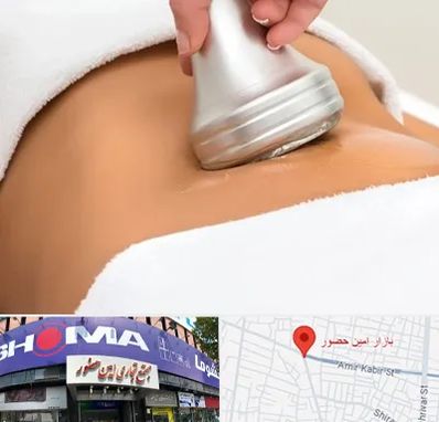 دستگاه لاغری در امین حضور