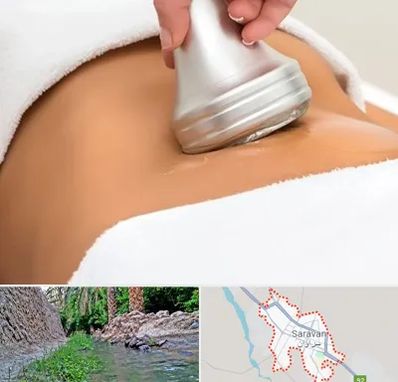دستگاه لاغری در سراوان