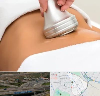 دستگاه لاغری در یاغچیان تبریز