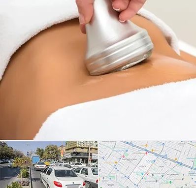 دستگاه لاغری در مفتح مشهد 