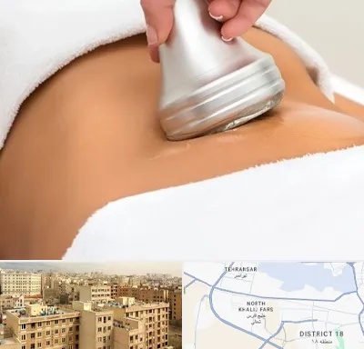 دستگاه لاغری در جنوب غرب تهران