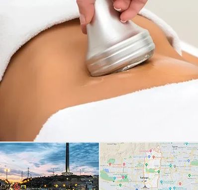 دستگاه لاغری در منطقه 2 تهران 