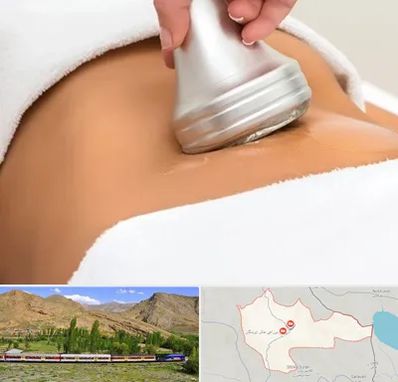 دستگاه لاغری در خاش