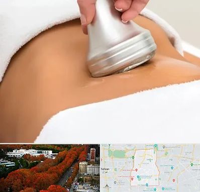 دستگاه لاغری در منطقه 6 تهران 