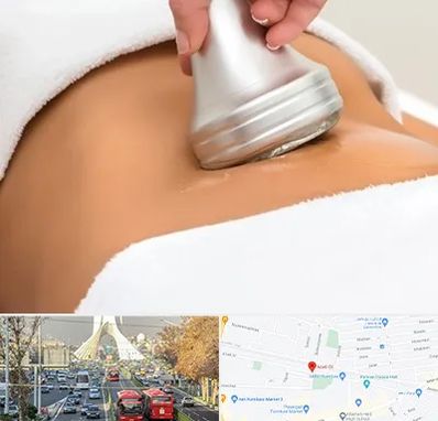 دستگاه لاغری در خیابان آزادی 