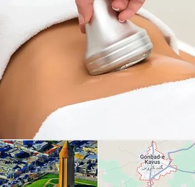 دستگاه لاغری در گنبد کاووس