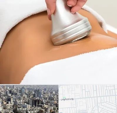 دستگاه لاغری در جیحون
