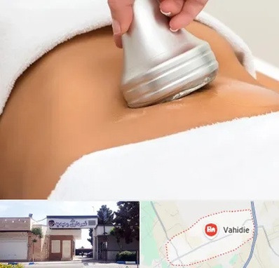 دستگاه لاغری در وحیدیه شهریار