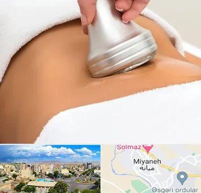 دستگاه لاغری در میانه