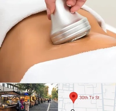 دستگاه لاغری در سی تیر