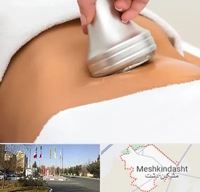 دستگاه لاغری در مشکین دشت
