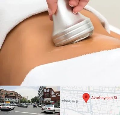 دستگاه لاغری در خیابان آذربایجان