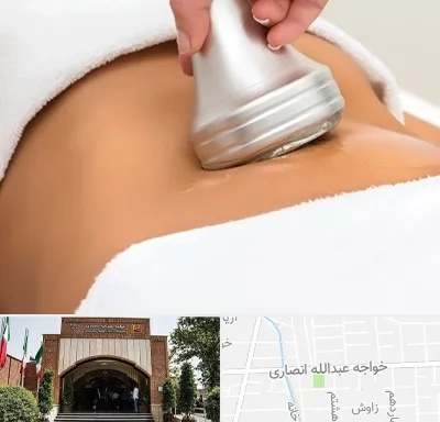 دستگاه لاغری در خواجه عبدالله