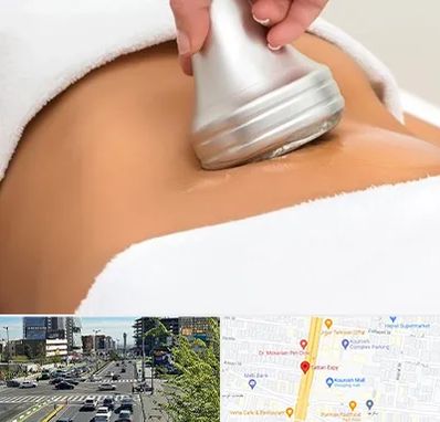 دستگاه لاغری در ستاری 