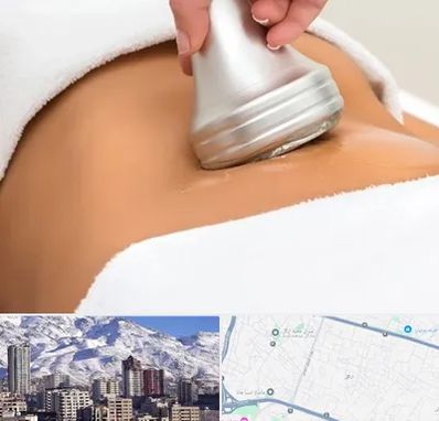 دستگاه لاغری در ازگل