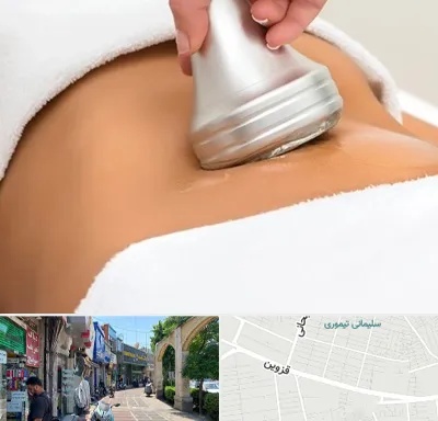 دستگاه لاغری در خیابان قزوین