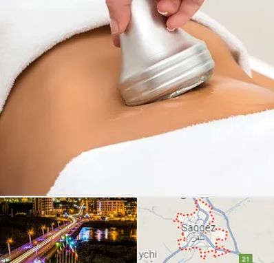 دستگاه لاغری در سقز