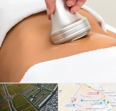 دستگاه لاغری در الهیه مشهد 