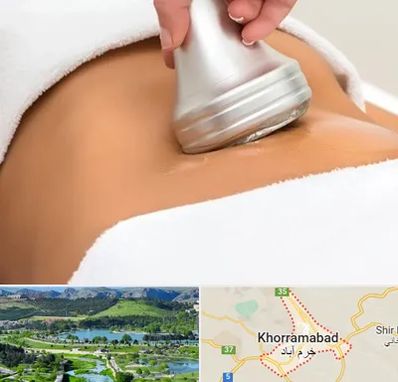 دستگاه لاغری در خرم آباد