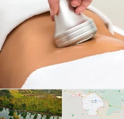 دستگاه لاغری در بهبهان