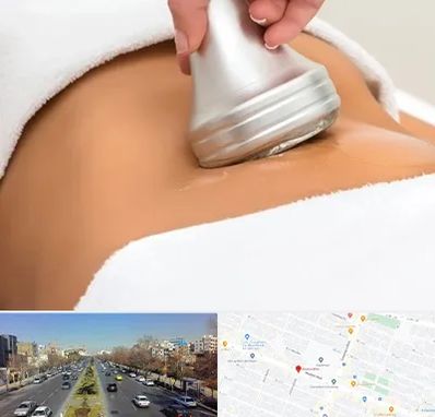 دستگاه لاغری در بلوار معلم مشهد 